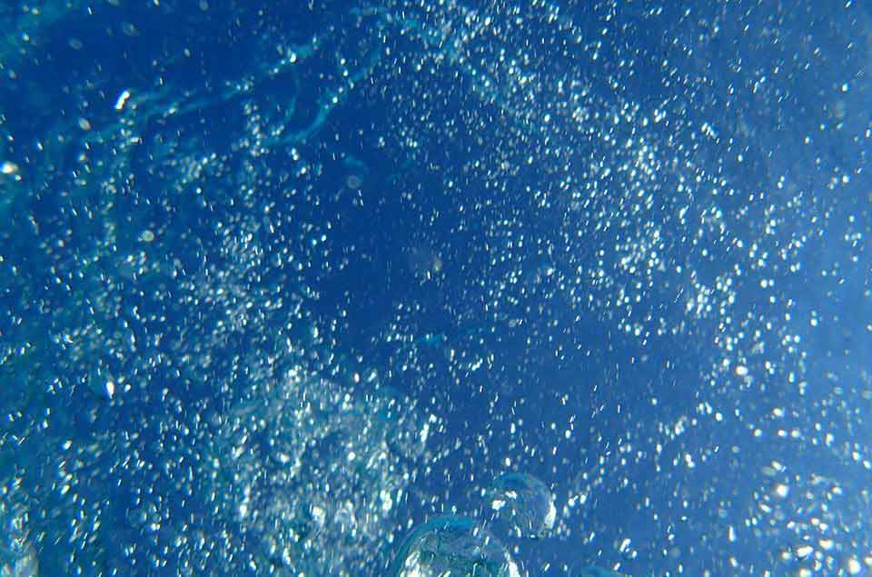 What Is Hyaluronic Acid In Skin Care? | Le Mag | Vichy USA ...