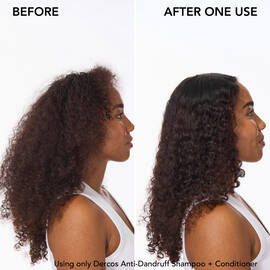 dercos conditioner before and after