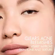 Normaderm PhytoAction Acne Control Moisturizer with Salicylic Acid