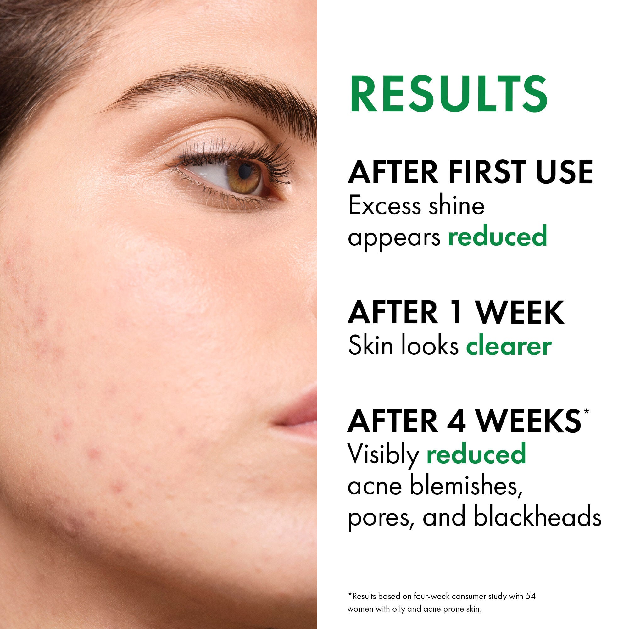 Normaderm PhytoAction Salicylic Acid Gel Cleanser