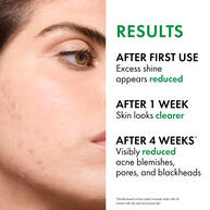 Normaderm PhytoAction Salicylic Acid Gel Cleanser