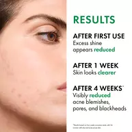 Normaderm PhytoAction Salicylic Acid Gel Cleanser