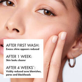 After the first wash using the Normaderm PhytoAction Daily Deep Cleansing Gel, excess shine appears reduced. After 1 week, skin looks clearer.