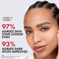 Liftactiv B3 Serum for Dark Spots