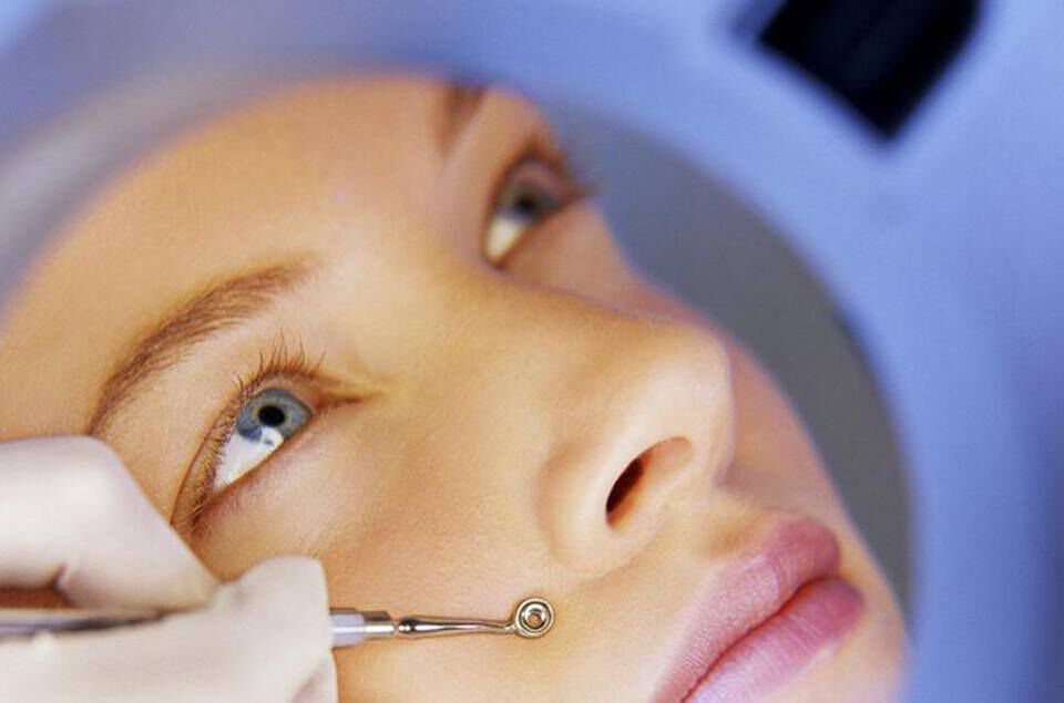 How To Get Rid Of Blackheads Le Mag Vichy Usa Skin Care