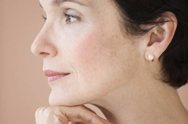 How To Get Rid Of Dark Spots On Your Face Vichy Skin Care Le Mag Vichy Usa How To Get Rid Of Dark Spots On Your Face Vichy Skin Care Le Mag Vichy Usa