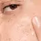 What is Oily Skin & How to Take Care of It
