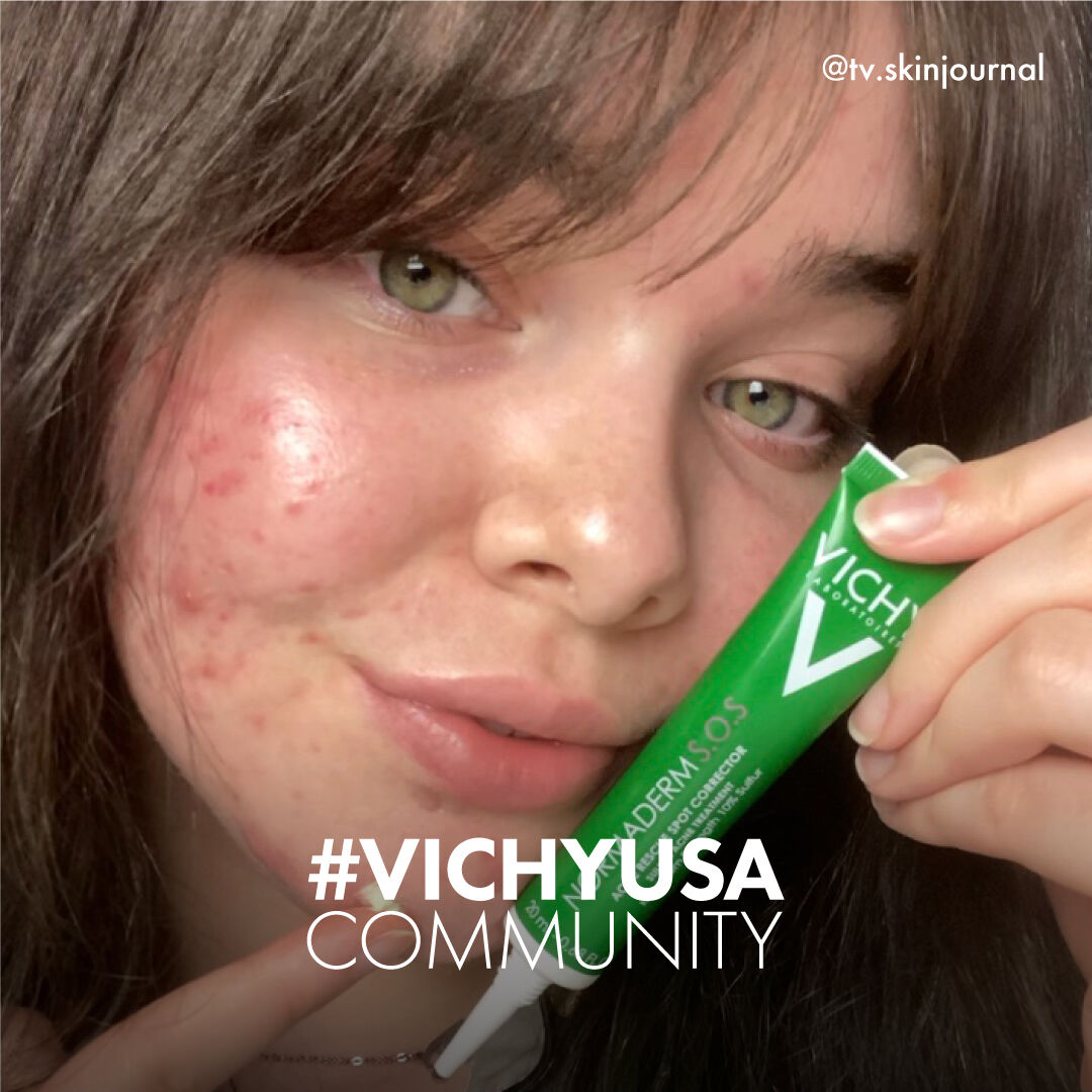 #VICHYUSA COMMUNITY