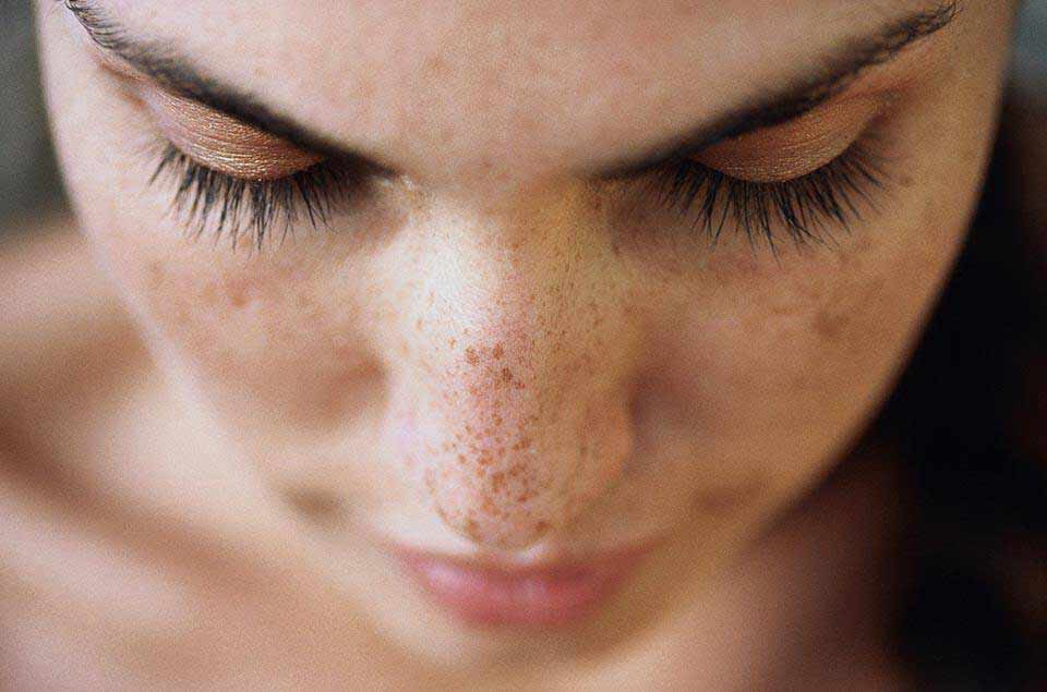 vichy cream for dark spots